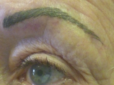 Left brow